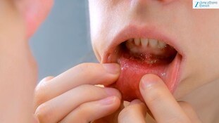 Lip Cancer: ਚਿਹਰੇ 'ਤੇ ਇਹ 3 ਬਦਲਾਅ ਹੋ ਸਕਦੇ ਹਨ ਲਿਪ ਕੈਂਸਰ ਦੇ ਸੰਕੇਤ! ਗਲਤੀ ਨਾਲ ਵੀ ਇਸਨੂੰ ਨਾ ਕਰੋ ਨਜ਼ਰਅੰਦਾਜ਼