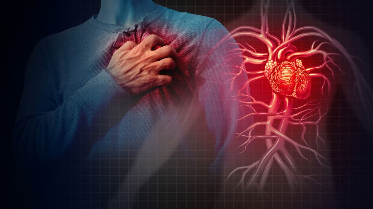 Heart Attack Risk